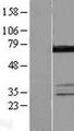 DDX55 Protein - Western validation with an anti-DDK antibody * L: Control HEK293 lysate R: Over-expression lysate