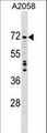 DDX56 Antibody - DDX56 Antibody western blot of A2058 cell line lysates (35 ug/lane). The DDX56 antibody detected the DDX56 protein (arrow).