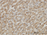 DDX56 Antibody - Immunoperoxidase of monoclonal antibody to DDX56 on formalin-fixed paraffin-embedded human liver. [antibody concentration 3 ug/ml]