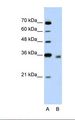 DECR2 Antibody - Lane A: Marker. Lane B: Jurkat cell lysate. Antibody concentration: 5.0 ug/ml. Gel concentration: 12%.  This image was taken for the unconjugated form of this product. Other forms have not been tested.