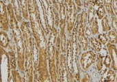 DEFA3 / Defensin Alpha 3 Antibody - 1:100 staining mouse kidney tissue by IHC-P. The sample was formaldehyde fixed and a heat mediated antigen retrieval step in citrate buffer was performed. The sample was then blocked and incubated with the antibody for 1.5 hours at 22°C. An HRP conjugated goat anti-rabbit antibody was used as the secondary.