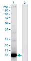 DEFA6 / Defensin 6 Antibody - Western Blot analysis of DEFA6 expression in transfected 293T cell line by DEFA6 monoclonal antibody (M01), clone 2D2.Lane 1: DEFA6 transfected lysate (Predicted MW: 11 KDa).Lane 2: Non-transfected lysate.
