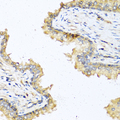 DEFB121 Antibody - Immunohistochemistry of paraffin-embedded human prostate.