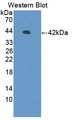 DEFB126 Antibody - Western blot of DEFB126 antibody.