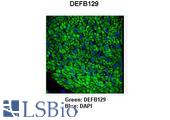 DEFB129 Antibody - DEFB129 antibody Immunohistochemistry of pig bronchus smooth muscle.  This image was taken for the unconjugated form of this product. Other forms have not been tested.
