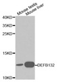 DEFB132 Antibody - Western blot analysis of extracts of various cell lines, using DEFB132 antibody at 1:1000 dilution. The secondary antibody used was an HRP Goat Anti-Rabbit IgG (H+L) at 1:10000 dilution. Lysates were loaded 25ug per lane and 3% nonfat dry milk in TBST was used for blocking.