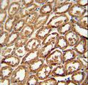 DEGS2 Antibody - DEGS2 antibody immunohistochemistry of formalin-fixed and paraffin-embedded human kidney tissue followed by peroxidase-conjugated secondary antibody and DAB staining.