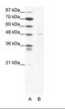 DEK Antibody - A: Marker, B: Jurkat Cell Lysate.  This image was taken for the unconjugated form of this product. Other forms have not been tested.