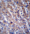 Delta-6 Desaturase / FADS2 Antibody - FADS2 Antibody immunohistochemistry of formalin-fixed and paraffin-embedded human liver tissue followed by peroxidase-conjugated secondary antibody and DAB staining.