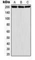 DENN / MADD Antibody - Western blot analysis of MADD expression in HeLa (A); A431 (B); K562 (C) whole cell lysates.