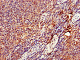 DENND1C Antibody - Immunohistochemistry of paraffin-embedded human lymph node tissue at dilution of 1:100