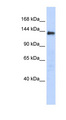 DENND2C Antibody - DENND2C antibody Western blot of Transfected 293T cell lysate. This image was taken for the unconjugated form of this product. Other forms have not been tested.