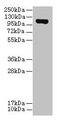 DENND2C Antibody - Western blot All lanes: DENND2C antibody at 8µg/ml + A431 whole cell lysate Secondary Goat polyclonal to rabbit IgG at 1/10000 dilution Predicted band size: 107, 95, 101 kDa Observed band size: 107 kDa