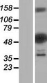 DENND2D Protein - Western validation with an anti-DDK antibody * L: Control HEK293 lysate R: Over-expression lysate