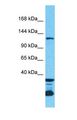 DENND3 Antibody - Western blot of DENND3 Antibody with human 786-0 Whole Cell lysate.  This image was taken for the unconjugated form of this product. Other forms have not been tested.