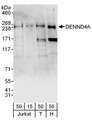 DENND4A Antibody - Detection of Human DENND4A by Western Blot. Samples: Whole cell lysate from Jurkat (15 and 50 ug), 293T (T; 50 ug) and HeLa (H; 50 ug) cells. Antibodies: Affinity purified rabbit anti-DENND4A antibody used for WB at 0.4 ug/ml. Detection: Chemiluminescence with an exposure time of 30 seconds.