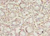 DENND5A Antibody - Immunohistochemistry of paraffin-embedded human rectum tissue using antibody at dilution of 1:100.