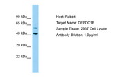 DEPDC1B Antibody -  This image was taken for the unconjugated form of this product. Other forms have not been tested.