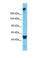 DEPDC2 Antibody - Western blot of Human HeLa. PREX2 antibody dilution 1.0 ug/ml.  This image was taken for the unconjugated form of this product. Other forms have not been tested.