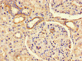 DEPDC2 Antibody - Immunohistochemistry of paraffin-embedded human renal tissue using PREX2 Antibody at dilution of 1:100