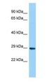 DERA Antibody - DERA antibody Western Blot of THP-1. Antibody dilution: 1 ug/ml.  This image was taken for the unconjugated form of this product. Other forms have not been tested.