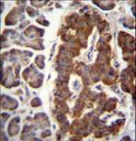 Dermatopontin / DPT Antibody - DPT Antibody immunohistochemistry of formalin-fixed and paraffin-embedded human pancreas tissue followed by peroxidase-conjugated secondary antibody and DAB staining.