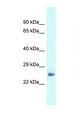 Dermatopontin / DPT Antibody - DPT / Dermatopontin antibody Western blot of Mouse Pancreas lysate. Antibody concentration 1 ug/ml.  This image was taken for the unconjugated form of this product. Other forms have not been tested.