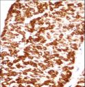 DES / Desmin Antibody - DES/Desmin (Muscle Cell Marker) Antibody immunohistochemistry of formalin-fixed and paraffin-embedded human heart tissue followed by peroxidase-conjugated secondary antibody and DAB staining.This data demonstrates the use of DES/Desmin (Muscle Cell Marker) Antibody for immunohistochemistry.