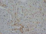 DES / Desmin Antibody -  This image was taken for the unconjugated form of this product. Other forms have not been tested.