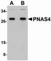 DESI2 / PPPDE1 Antibody - Western blot of PNAS4 in EL4 cell lysate with PNAS4 antibody at (A) 1 and (B) 2 ug/ml.