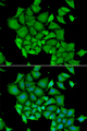 DFFA / ICAD / DFF45 Antibody - Immunofluorescence analysis of HeLa cells using DFFA antibody. Blue: DAPI for nuclear staining.