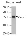 DGAT1 Antibody - Western blot analysis of extracts of Mouse heart tissue, using DGAT1 antibody.