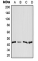 DGAT2 Antibody - Western blot analysis of DGAT2 expression in Raji (A); HeLa (B); SP2/0 (C); H9C2 (D) whole cell lysates.