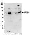 DGCR14 Antibody - Detection of human and mouse DGCR14 by western blot. Samples: Whole cell lysate (50 µg) from HeLa, HEK293T, Jurkat, mouse TCMK-1, and mouse NIH 3T3 cells prepared using NETN lysis buffer. Antibodies: Affinity purified rabbit anti-DGCR14 antibody used for WB at 1 µg/ml. Detection: Chemiluminescence with an exposure time of 3 minutes.