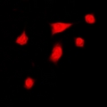DGK-IOTA / DGKI Antibody - Immunofluorescent analysis of DGK iota staining in HeLa cells. Formalin-fixed cells were permeabilized with 0.1% Triton X-100 in TBS for 5-10 minutes and blocked with 3% BSA-PBS for 30 minutes at room temperature. Cells were probed with the primary antibody in 3% BSA-PBS and incubated overnight at 4 deg C in a humidified chamber. Cells were washed with PBST and incubated with a DyLight 594-conjugated secondary antibody (red) in PBS at room temperature in the dark. DAPI was used to stain the cell nuclei (blue).