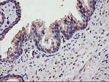 DGKA Antibody - IHC of paraffin-embedded Human prostate tissue using anti-DGKA mouse monoclonal antibody.