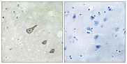 DGKK Antibody - Immunohistochemistry analysis of paraffin-embedded human brain tissue, using DGKK Antibody. The picture on the right is blocked with the synthesized peptide.