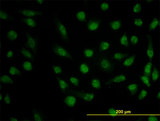 DHFR Antibody - Immunofluorescence of monoclonal antibody to DHFR on HeLa cell. [antibody concentration 10 ug/ml]