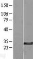 DHRS11 / MGC4172 Protein - Western validation with an anti-DDK antibody * L: Control HEK293 lysate R: Over-expression lysate