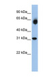 DHRS2 / HEP27 Antibody - DHRS2 antibody Western blot of 721_B cell lysate. This image was taken for the unconjugated form of this product. Other forms have not been tested.