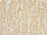 DHRS3 / SDR1 Antibody - Immunohistochemistry of paraffin-embedded human adrenal gland tissue using antibody at dilution of 1:100.