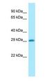 DHRS4 / PSCD Antibody - DHRS4 / PSCD antibody Western Blot of COLO205.  This image was taken for the unconjugated form of this product. Other forms have not been tested.
