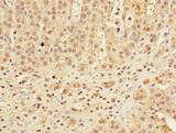 DHX30 Antibody - Immunohistochemistry of paraffin-embedded human adrenal gland tissue using antibody at dilution of 1:100.