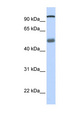 DHX32 Antibody - DHX32 antibody Western blot of Fetal Lung lysate. This image was taken for the unconjugated form of this product. Other forms have not been tested.