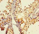 DHX35 Antibody - Immunohistochemistry of paraffin-embedded human testis tissue using DHX35 Antibody at dilution of 1:100