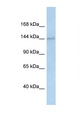 DHX38 Antibody - DHX38 antibody Western blot of Rat Brain lysate. Antibody concentration 1 ug/ml.  This image was taken for the unconjugated form of this product. Other forms have not been tested.