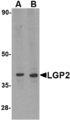 DHX58 / LGP2 Antibody - Western blot of LGP2 in MDA-MB-361 cell lysate with LGP2 antibody at (A) 0.5 and (B) 1 ug/ml.