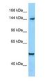 DIAPH1 Antibody - DIAPH1 antibody Western Blot of HepG2.  This image was taken for the unconjugated form of this product. Other forms have not been tested.