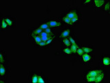 DIAPH3 / MDIA2 Antibody - Immunofluorescent analysis of HepG2 cells using DIAPH3 Antibody at dilution of 1:100 and Alexa Fluor 488-congugated AffiniPure Goat Anti-Rabbit IgG(H+L)