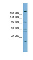 DIP2A Antibody - DIP2A antibody Western blot of HT1080 cell lysate. This image was taken for the unconjugated form of this product. Other forms have not been tested.